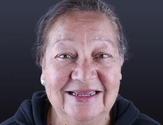 Before — implant case